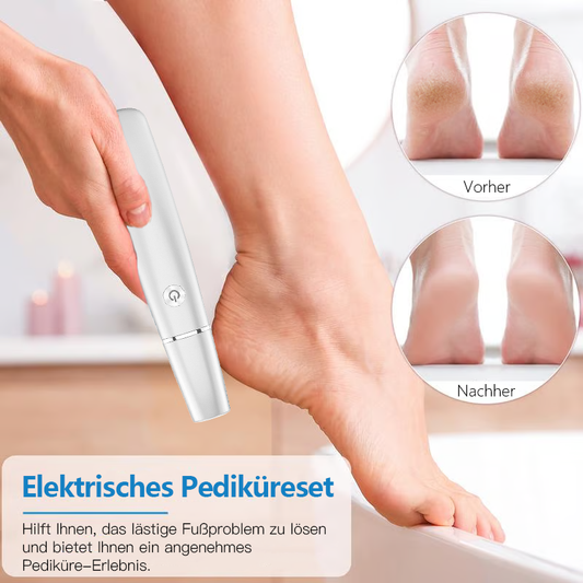 💥 Hot Sale 60% Rabatt💥Elektrischer Hornhautentferner für die Füße👣