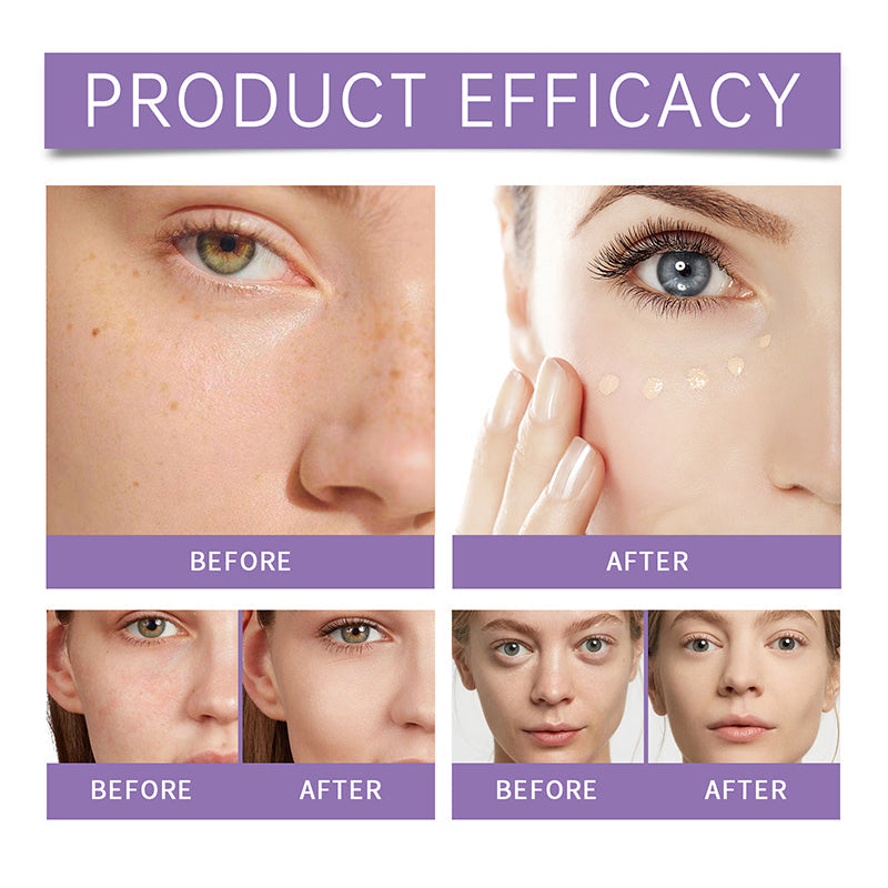 💖【Perfect Concealer BB Cream】 – Ein Auftrag genügt, um Unreinheiten verschwinden zu lassen – die Haut strahlt wie von Natur aus! ✨