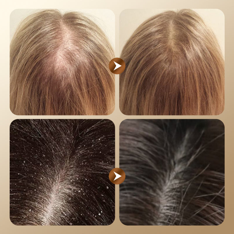 Kräuter-Shampoo gegen Haarausfall und für Haarwachstum